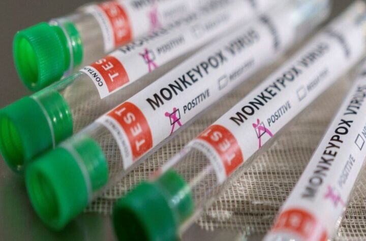 A OMS decidiu hoje (23) declarar que a varíola dos macacos configura emergência de saúde pública de interesse internacional.