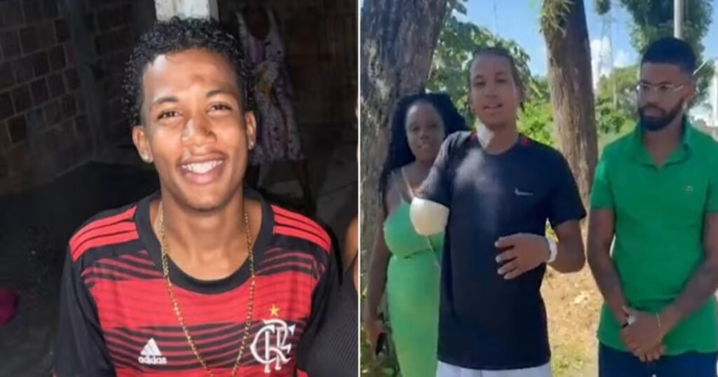 Andrei Peroba Bispo Cerqueira, de 20 anos, teve o braço esmagado por um brinquedo e ficou mais de um mês internado