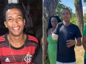 Andrei Peroba Bispo Cerqueira, de 20 anos, teve o braço esmagado por um brinquedo e ficou mais de um mês internado